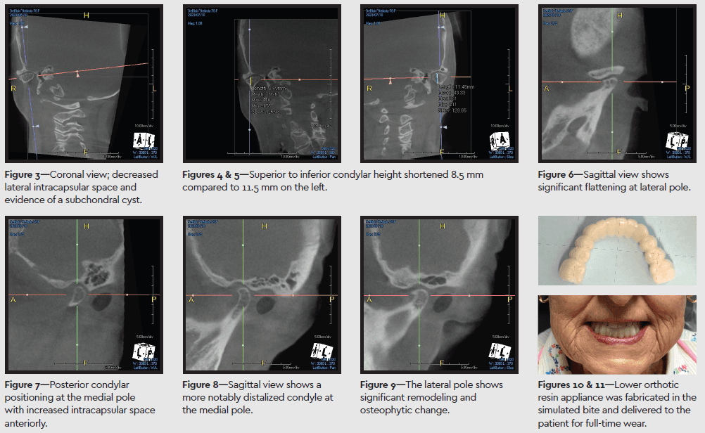 prexcbct02.png