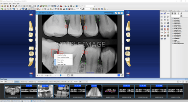 Dentrix Detect AI