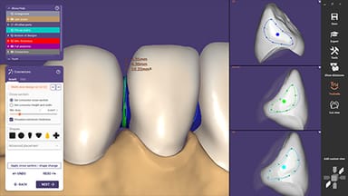  exocad DentalCAD 3.0 Galway