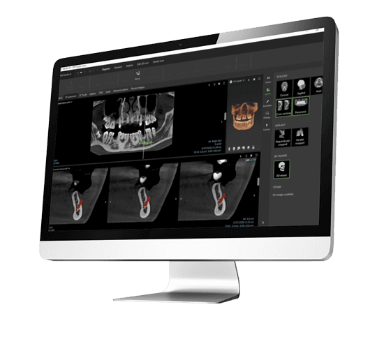 Newsfeed Thumbnail: DTX_Product_hero2.png