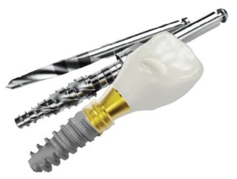 Newsfeed Thumbnail: bion1implant.jpg