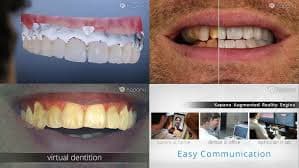 Newsfeed Thumbnail: kapanuimage.jpg