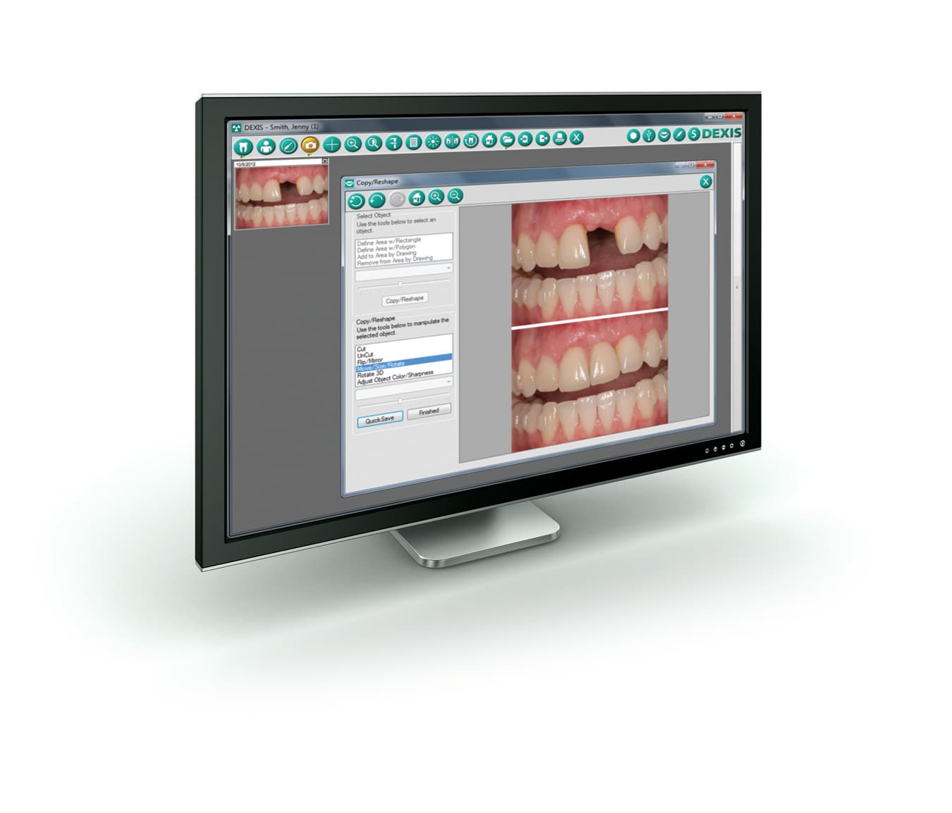 Newsfeed Thumbnail: /product_images/D/Dexis_Llc/DPS_Web/DEXIS-LL_DEXIS-Imaging-Suite_83186.jpg